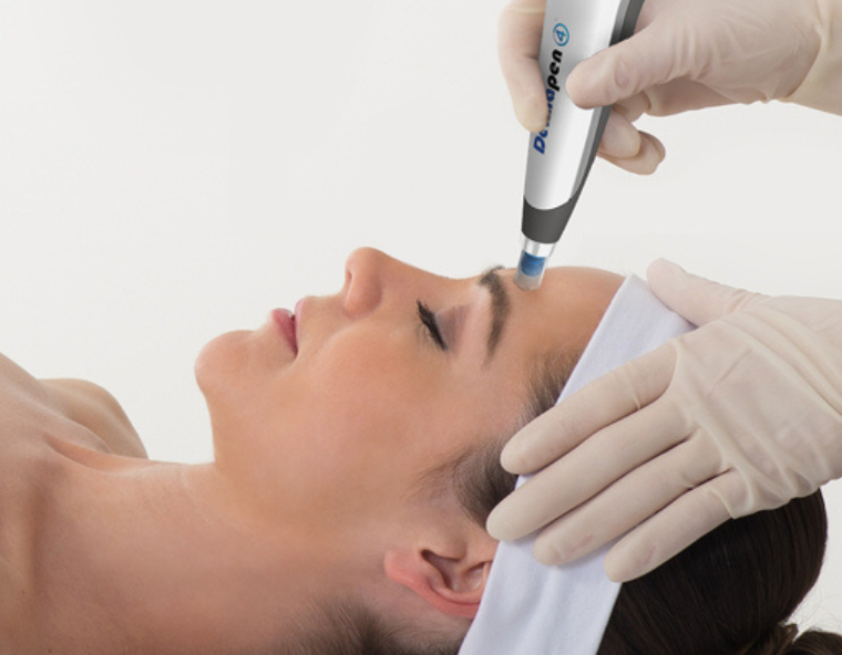 Dermapen 4 Treatments | Dermal Medik Clinic Gold Coast